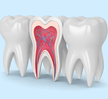 What Is A Root Canal Treatment And When Should You Get One?