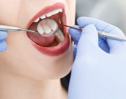 What is Deep Teeth Cleaning?