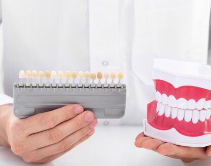 VENEERS 