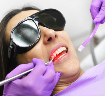 What Is Laser Dentistry? How Does It Work?
