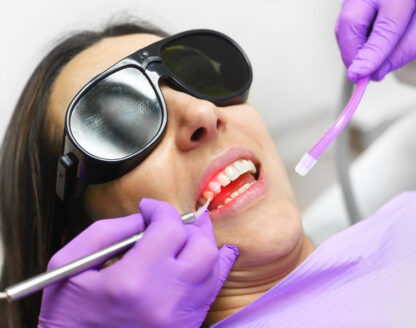 What Is Laser Dentistry? How Does It Work?