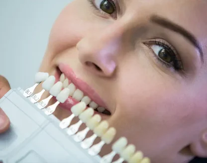 What to Expect Before, During, and After Getting Veneers 